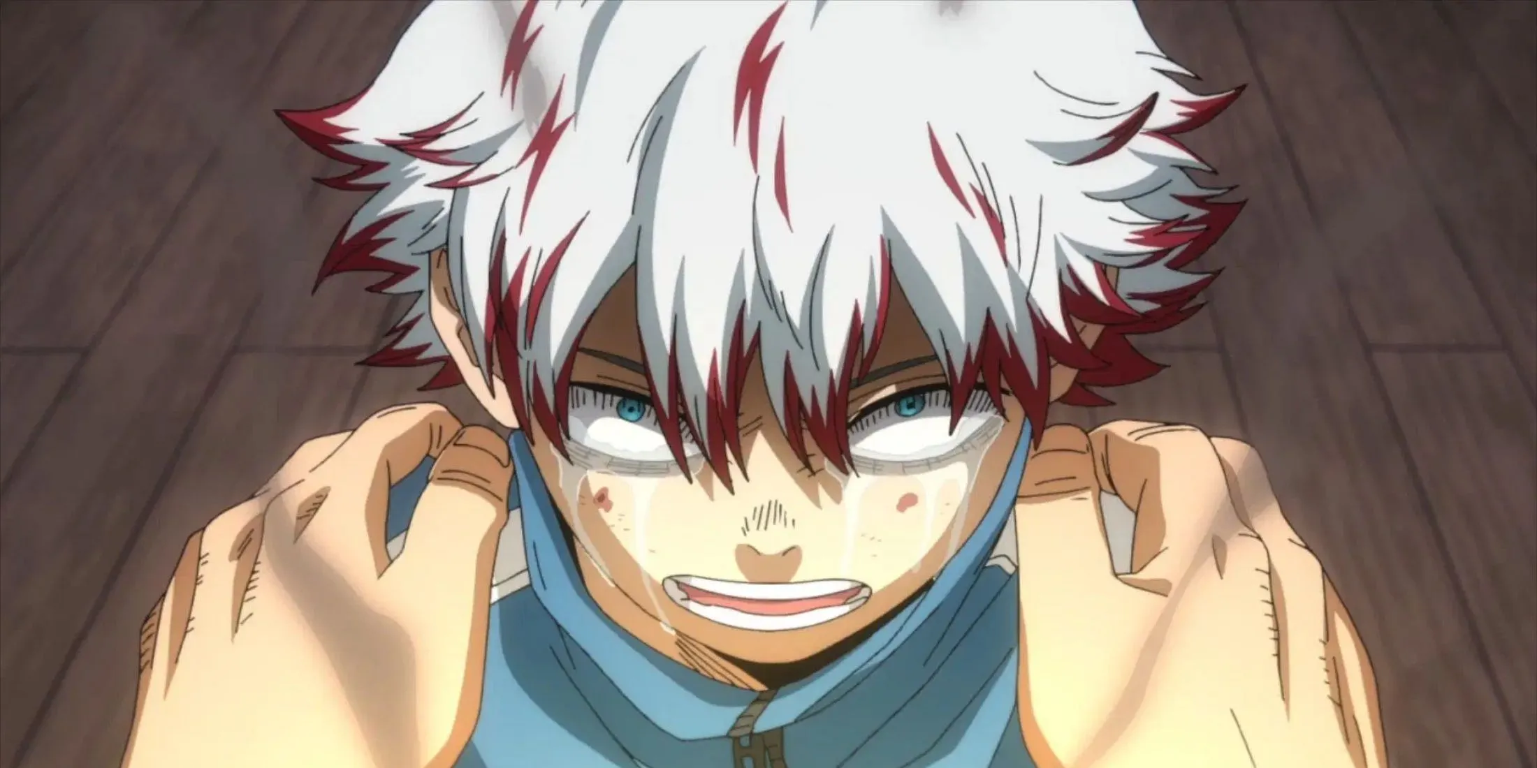 Toya Todoroki, hay Dabi, trong My Hero Academia với những vết bỏng và ngọn lửa xanh